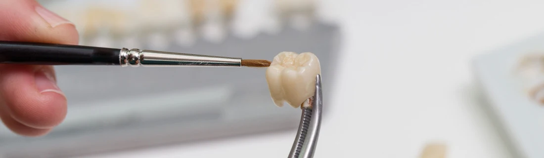 A Professional Holding a Paint Brush is Creating a New Tooth Cap Crown Restorative Dentistry